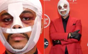 The Weeknd deixa fãs espantados ao aparecer com o rosto “enfaixado e machucado” no AMA’s 2020